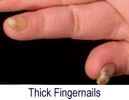 thick fingernails doctor Clinton Township